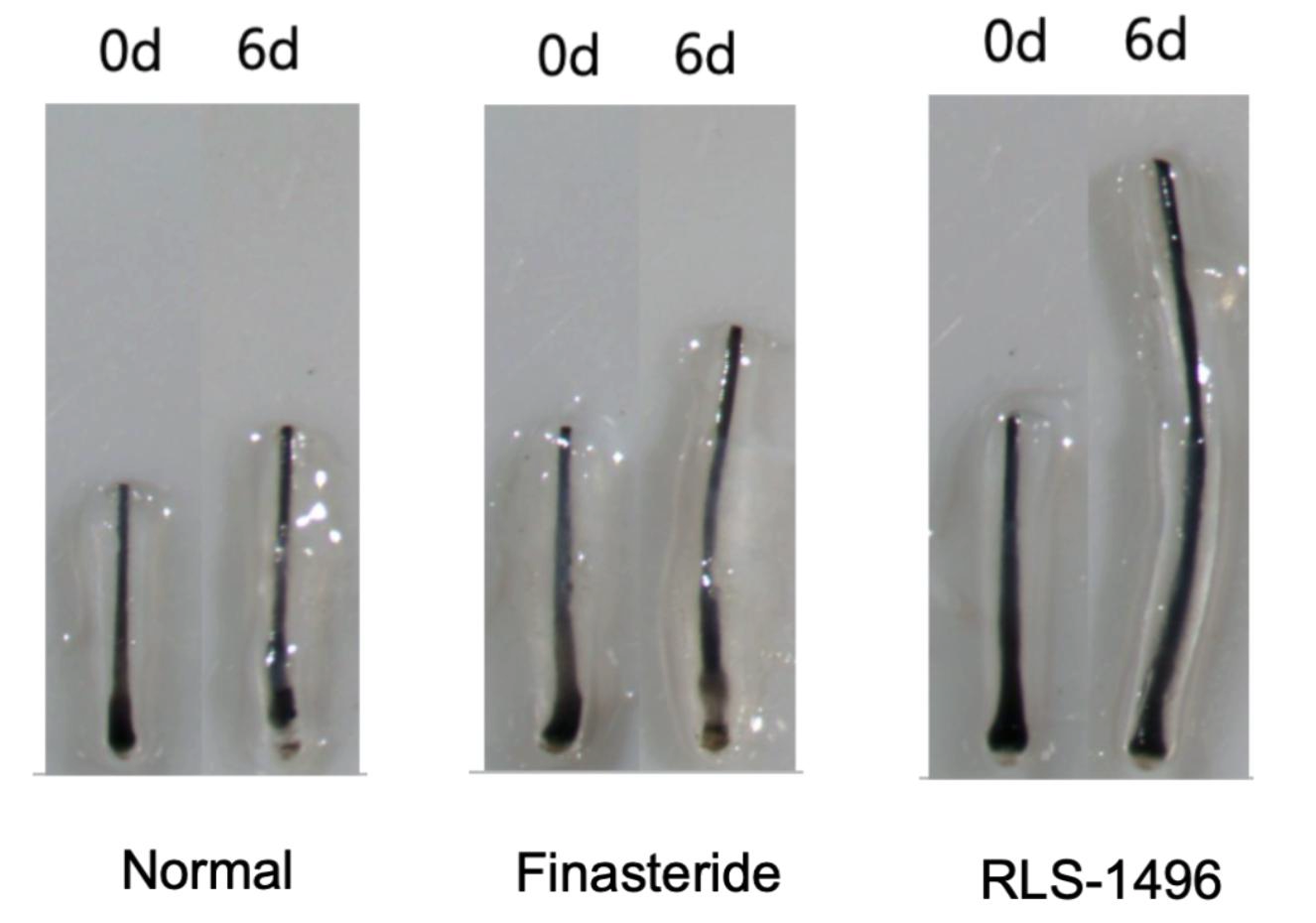 Human hair follicles at days 0 and 6