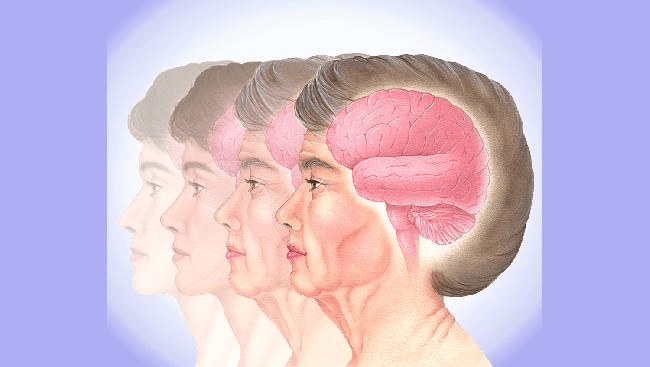 Aging mouse brain research figure